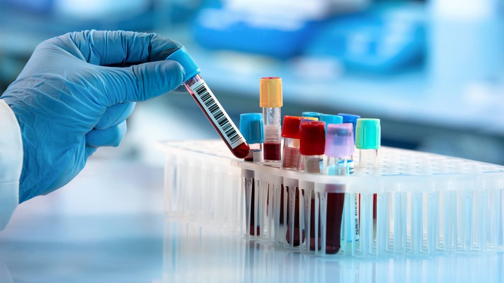 &laquo;Coronavirus, possibile sovrastima dei casi&raquo;: studio dell’Universit&agrave; di Oxford