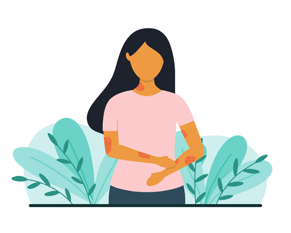 Psoriasi e artrite psoriasica: l&rsquo;approccio della macrobiotica